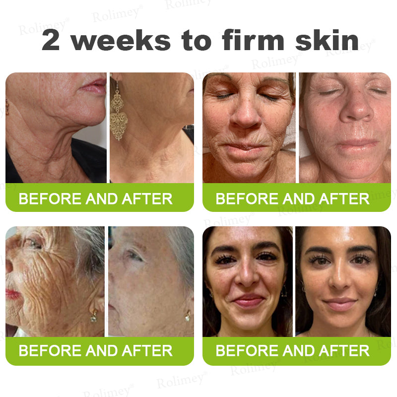 💥Buy 5 Get 3 Free - Deep Anti-Aging