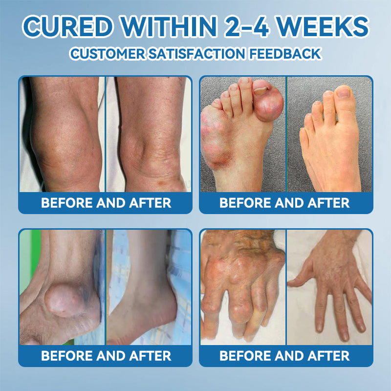 𝖯𝗂𝖼𝗱𝗈® BPC-157 Krem regenerujący stawy 🦴 Skutecznie łagodzi artretyzm, neuropatię, reumatyzm, kontuzje sportowe i wiele więcej 👍👍👍👍👍