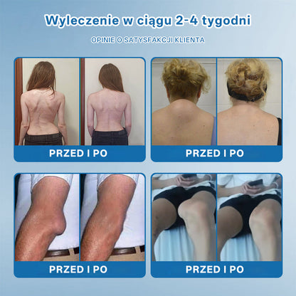 ⭐𝖯𝗂𝖼𝗱𝗈® BPC-157 Krem regenerujący stawy 🦴⭐ Rekomendowany przez specjalistów ortopedów,Skutecznie łagodzi artretyzm, neuropatię, reumatyzm, kontuzje sportowe i wiele więcej 👍👍