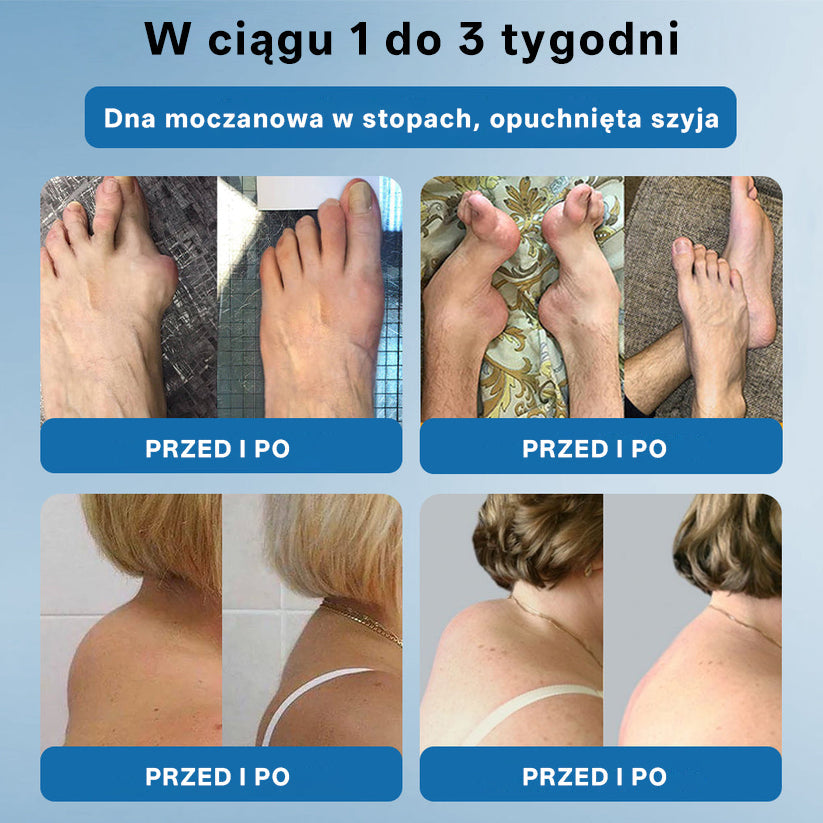 ⭐𝖯𝗂𝖼𝗱𝗈® BPC-157 Krem regenerujący stawy 🦴⭐ Rekomendowany przez specjalistów ortopedów,Skutecznie łagodzi artretyzm, neuropatię, reumatyzm, kontuzje sportowe i wiele więcej 👍👍