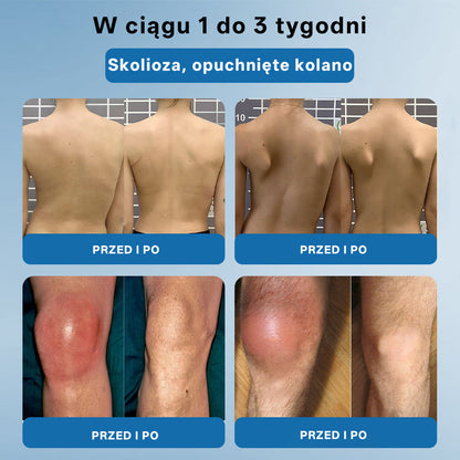 ⭐𝖯𝗂𝖼𝗱𝗈® BPC-157 Krem regenerujący stawy 🦴⭐ Rekomendowany przez specjalistów ortopedów,Skutecznie łagodzi artretyzm, neuropatię, reumatyzm, kontuzje sportowe i wiele więcej 👍👍