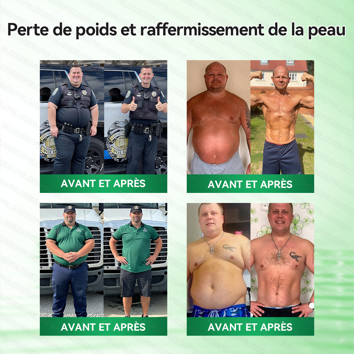 𝐁𝐨𝐮𝐭𝐢𝐪𝐮𝐞 𝐎𝐟𝐟𝐢𝐜𝐢𝐞𝐥𝐥𝐞 | 🍀𝐆𝐋𝐎𝑹𝑬𝗡𝗗𝗔® 𝑴𝒐𝒓𝒊𝒏𝙜𝙖 · 𝘽𝙚𝙧𝙗𝙚𝙧𝒊𝒏𝒆 × 𝐍𝐴𝑫+ 𝟏𝟎-𝗲𝗻-𝟏 𝑵𝒂𝙣𝙤 𝑴𝒊𝒄𝒓𝒐𝒏𝒆𝒆𝗱𝗹𝗲 𝐀𝐯𝐚𝐧𝐜é 𝑝𝒶𝘵𝖼𝚑 🇫🇷 (𝐔𝐧𝐞 𝐬𝐞𝐮𝐥𝐞 𝐟𝐨𝐢𝐬 𝐩𝐚𝐫 𝐣𝐨𝐮𝐫) ✅ 𝐏𝐨𝐮𝐫 𝐥’𝐨𝐛é𝐬𝐢𝐭é, 𝐩𝐞𝐚𝐮 𝐫𝐞𝐥â𝐜𝐡é𝐞, 𝐝𝐢𝐚𝐛è𝐭𝐞, 𝐚𝐩𝐧é𝐞 𝐝𝐮 𝐬𝐨𝐦𝐦𝐞𝐢𝐥, 𝐩𝐫𝐨𝐛𝐥è𝐦𝐞𝐬 𝐚𝐫𝐭𝐢𝐜𝐮𝐥𝐚𝐢𝐫𝐞𝐬, 𝐞𝐭 𝐛𝐢𝐞𝐧 𝐩𝐥𝐮𝐬🎁